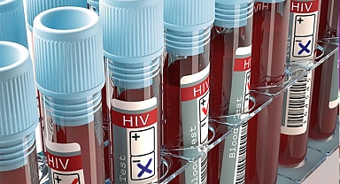 Türkiye'deki HIV Pozitif Kişi Sayısı Son 10 Yılda 4 Katına Çıktı