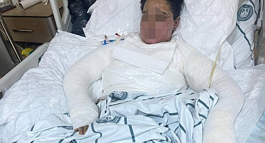 Diyarbakır'da Eve Getirdikleri Uyuşturucuyu Polise Şikayet Edeceğini Söyleyen Kadının Eşi ve Kayınbiraderi Üstüne Ütü Bastı, Kolonya ile Yakmaya Çalıştı: Beni Öldürecekler 