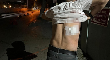 Mesaisi Bittiği İçin Kendisini Almayan Taksiciyi Makasla Yaraladı