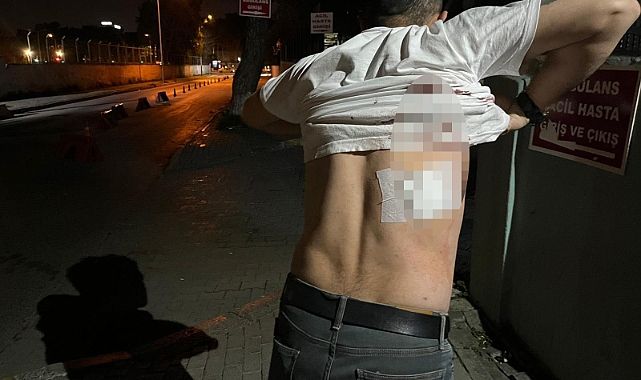 Mesaisi Bittiği İçin Kendisini Almayan Taksiciyi Makasla Yaraladı