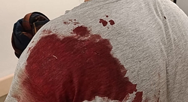 Etimesgut'ta Bıçaklı Saldırıya Uğrayan Zafer Partili Furkan Kutlu'nun Fotoğrafları Servis Edildi