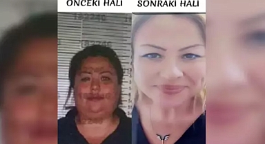 Kardeşinin Kimliğini Kullanmak İçin Estetik Yaptıran Çek Dolandırıcısını Jandarma Yakaladı 
