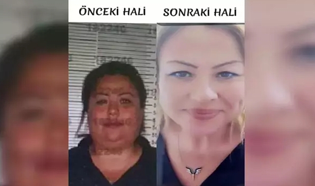 Kardeşinin Kimliğini Kullanmak İçin Estetik Yaptıran Çek Dolandırıcısını Jandarma Yakaladı