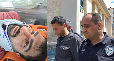 Amasya'da Engelli Komşusunun Burnunu Kırıp Sıcak Su ile Yakan Şahıs Adli Kontrolle Serbest Bırakıldı