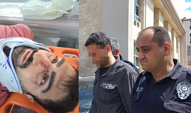 Amasya'da Engelli Komşusunun Burnunu Kırıp Sıcak Su ile Yakan Şahıs Adli Kontrolle Serbest Bırakıldı