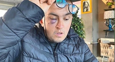 İstanbul Sultangazi'de Bir Engelliye Yumruklu Saldırı 
