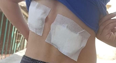 Başıboş Köpek Terörü Hız Kesmeden Devam Ediyor: Diyarbakır'da Başıboş Köpekler 8 Yaşındaki Çocuğa Saldırdı