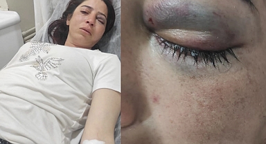Kadına Yönelik Şiddet Hız Kesmeden Devam Ediyor: Kocasından Kaçarken Öz Kardeşinden Şiddet Gördü