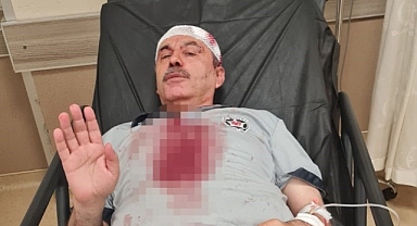 İstanbul Bağcılar'da Yabancı Uyruklu Saldırganlar Dehşet Saçtı: Güvenlik Görevlisiyle Bekçi Köpeğine Taşlı Sopalı Saldırı Düzenlediler