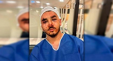 Avusturya'da 20 Kişilik Suriyeli Çete Sokakta Gördüğü Türklere Saldırıyor
