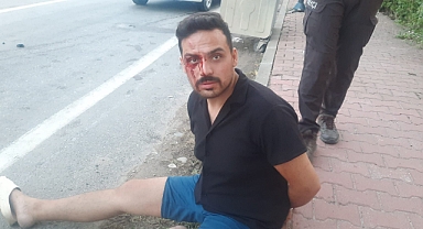 Boşanma Aşamasında Olduğu Erkek Tarafından Tüfekle Vurulan Kadının Olayda 5 Saat Önce Sosyal Medyadan Yardım İstediği Ortaya Çıktı