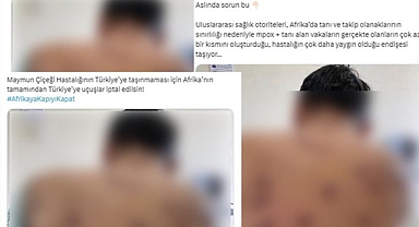 Cumhurbaşkanlığı'ndan 'Maymun Çiçeği Virüsü' Açıklaması: Görüntüler Gerçeği Yansıtmıyor