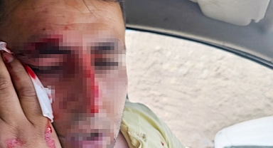 Şırnak'ta Kaçak Elektrik Kontrolü Yapan Görevlilere Saldırdılar