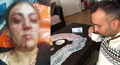 Eski Eşi Tarafından Çocuklarının Gözü Önünde Bıçaklanan Kadın, Eski Eşine Çocuklarını Göstermediği İçin Cezaevine Girdi
