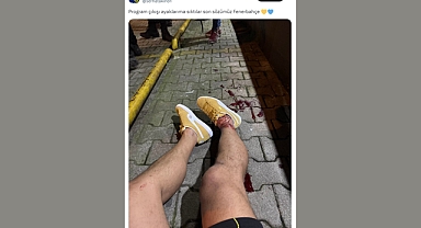 Eski Futbolcu Serhat Akın Program Çıkışı Ayağından Vuruldu