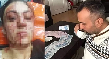 Boşandığı Kadını 7 Yerinden Bıçaklayan Şiddet Faili Erkek: 'İstesem Öldürmez Miydim? Medya Baskısıyla Tutuklandım'