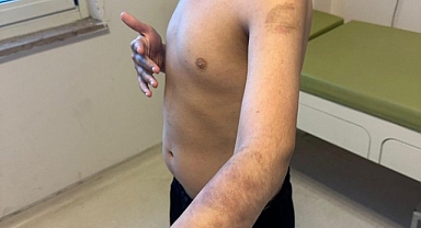 Beylikdüzü'ndeki Bir Özel Eğitim Kurumunda, 9 Yaşındaki Otizmli Öğrenciye Şiddet İddiası: 'Beğenmiyorsanız Kendiniz Baksaydınız'