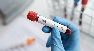 İzmir'de Doktorları Endişelendiren Vaka: 13 Yaşında Bir Çocuk AIDS Nedeniyle Hayatını Kaybetti