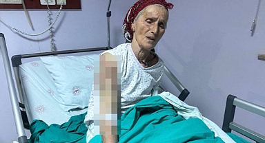 65 Yaşındaki Kadına 7 Köpek Saldırdı: Vücuduna 50 Dikiş Atıldı