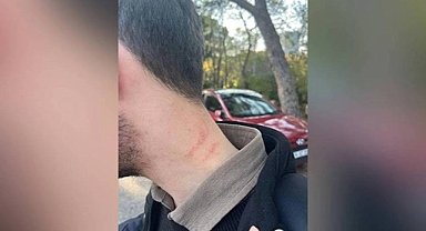 Medipol Üniversitesi'nde Dekan Yardımcısı Öğrenciyi Darp Etti İddiası
