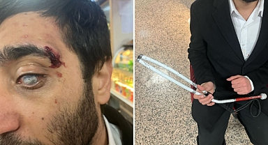 Ankara'daki Eylemler Esnasında Görme Engelli Bir Vatandaş Polis Ekiplerinin Şiddetine Maruz Kaldı