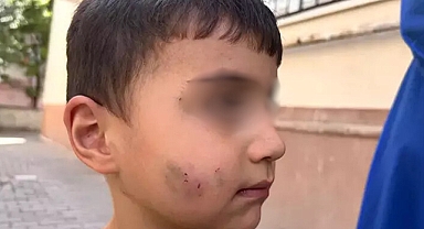 Sincan’da Dehşet: Küçük Çocuğu Uykusunda Lağım Faresi Isırdı