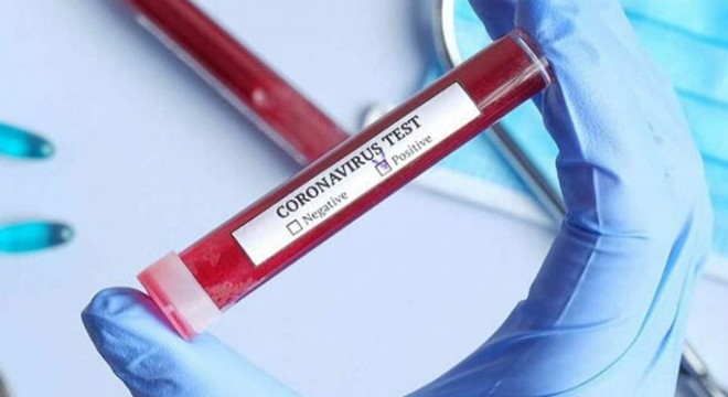 Çin Virüsü Son 24 Saatte 98 Can Daha Aldı