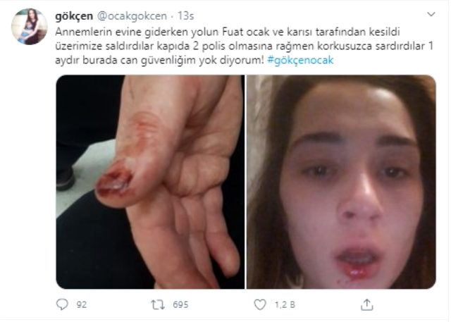 Eşinin Amcasının Tekrar Saldırısına Uğrayan Kadın: Ölmek İstemiyorum