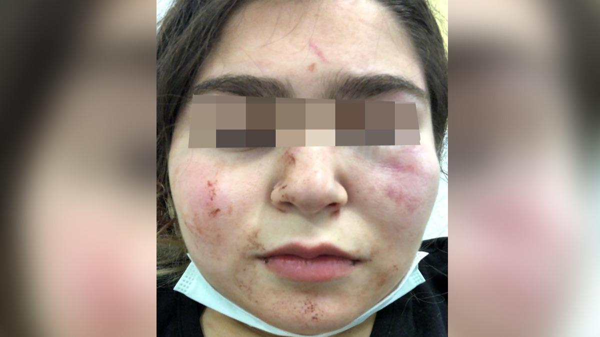 Alman Polisinden Türk Gence Şiddet