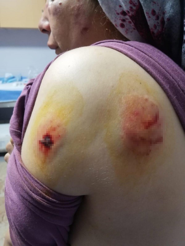 Ceza Evinden Çıkıp Karısını Öldüresiye Dövdü
