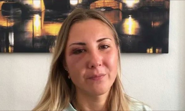 Fransa'da Bir Kadın Etek Giydiği İçin Darp Edildi