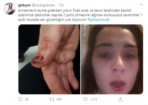 Eşinin Amcasının Tekrar Saldırısına Uğrayan Kadın: Ölmek İstemiyorum