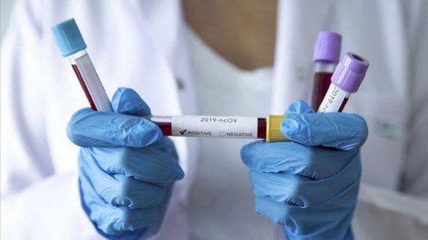 Çin Virüsünde Son 24 Saat: 78 Can Kaybı, 2322 Yeni Hasta