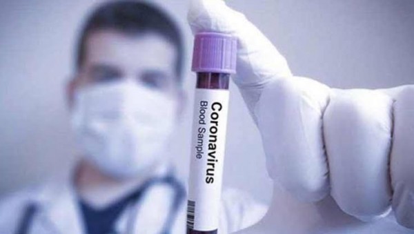 Çin Virüsünde Vehamet Devam Ediyor: 92 Vefat, 3116 Yeni Hasta