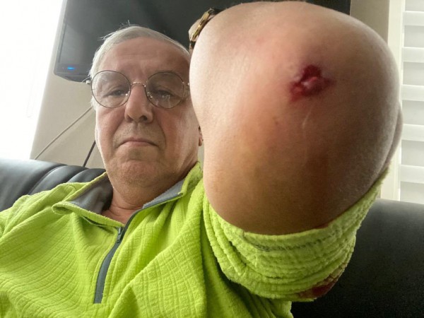 Orhan Uğuroğlu'nu Darp Eden Şüpheliler Serbest Bırakıldı