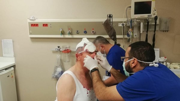 Selçuk Özdağ'a Saldıran 3 Şüpheli Hakkında Yakalama Kararı Çıkarıldı