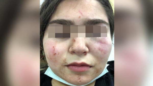 Alman Polisinden Türk Gence Şiddet