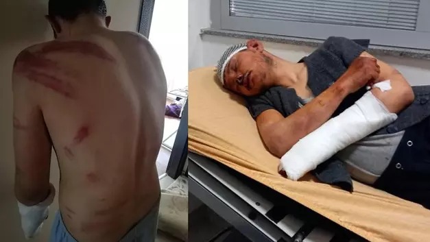 200 Liralık Yevmiye Yüzünden 16 Yaşındaki Genci Öldüresiye Dövdüler