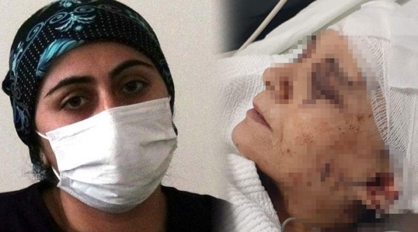 Erkek Dehşeti: Çalışmasını İstemediği Eşini Satırla Kovalayıp Parmağını Kopardı