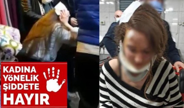Yolda Yürüyen Kadına Muşta ile Saldıran Şahıs 'Birine Benzettim' Dedi