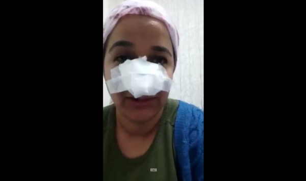 Uzman Çavuş, Bir Kadını Darp Etti İddiası