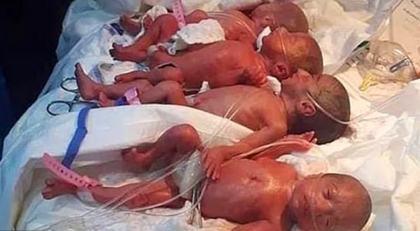 Sezaryen Ameliyatı ile Tam 9 Bebek Doğurdu
