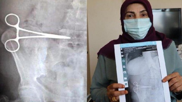 Aydın'da Bir Kadının Karnında 'Makas' Unuttular 