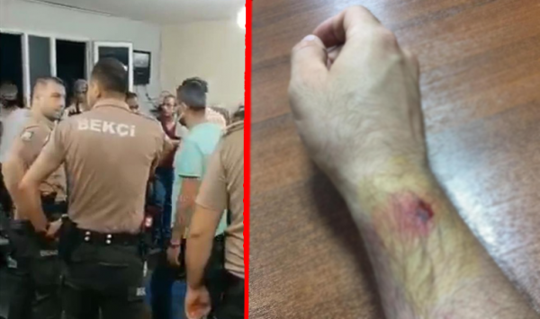 Yer: Adana, Kumarhane Baskınında Polise Isırarak Saldırdı