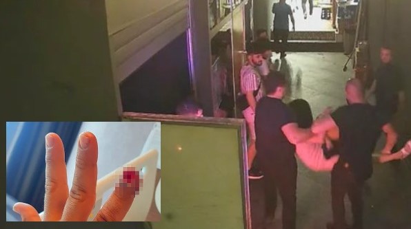 Gece Kulübüne Alınmayan Kadın, Güvenlik Görevlisinin Parmağını Kopardı