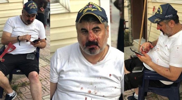 Komşularını Gazi Olduğunu Bile Bile Darbettiler