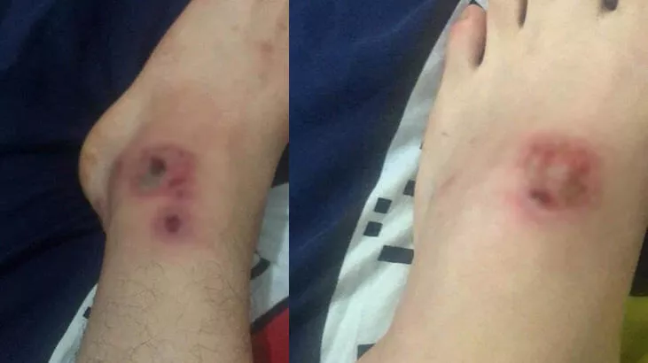 Asya Kaplan Sivrisineği İstanbul'da Yerleşik Türler Arasına Girdi