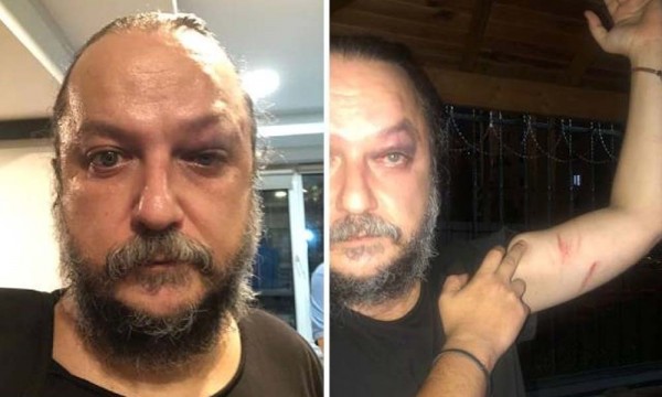 Güvenç Dağüstün Konser Sonrası Saldırıya Uğradı