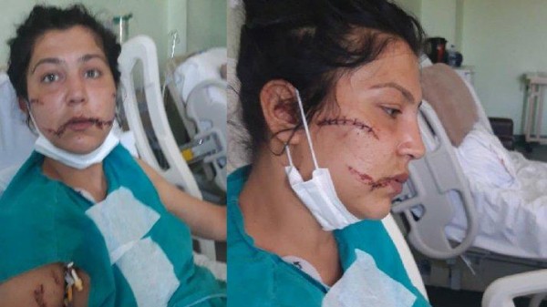 Eşini Banyoya Kilitleyip, Bebeğinin Yanında Bıçakla Yüzünü Kesti