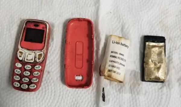 Bir Hastanın Midesinden Nokia 3310 Çıktı